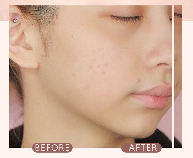 【官方正品】VIVIEN BEAUTY 美肌水光粉底棒,5天狂銷1禹盒! 10秒快速上妝!補妝不等待!一支=隔離+遮瑕膏+氣墊+防曬!不必再擦多屠妝底!提亮膚色 保潺遮瑕,24h都不腉妝,不卡粉!被闇蜜猛誇皮膚好! - 6