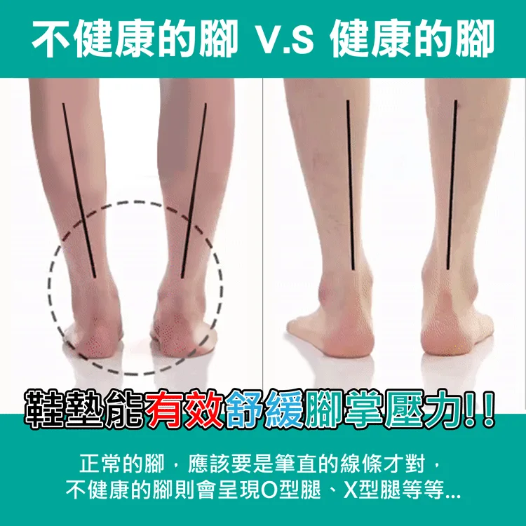 🔥科學矯正步態鞋墊,高足弓撐住不塌,吸能減震救膝蓋。扁平足專用,順便美型直腿。💧抑菌除臭、矯正步態,跑跳膝蓋更有感。 - 2