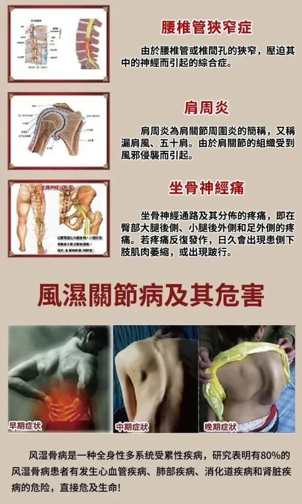 💪阿爸阿母的腰腿不再痠痛,苗疆透骨膏深層穿透力強!直達痠痛根源持續釋放療效,長時間維持修復效果,腰腿疼痛、關節、頸椎、肩周不適,一擦有感📢衛福部認證,讓你遠離疼痛輕鬆活動每一天🔥 - 7